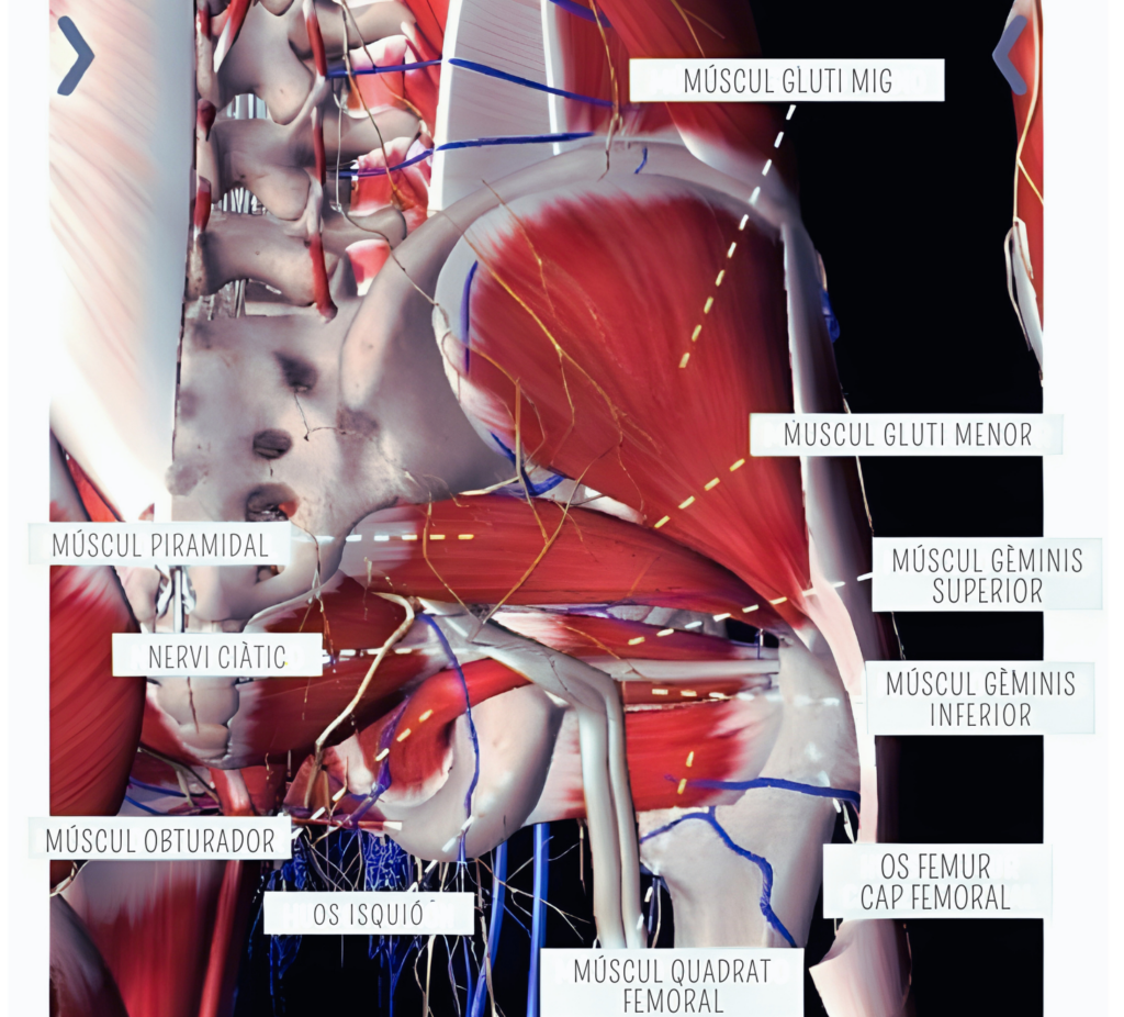 Esquema sobre los músculos que intervienen en el síndrome del glúteo profundo